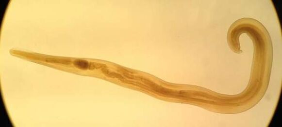 Oxiuroa