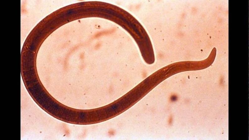 Trichinella