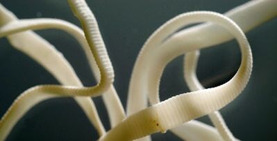 giza gorputzetik bizkarroi laua